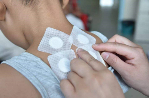 贴三伏贴后皮肤红痒起泡？如何正确处理缓解不适