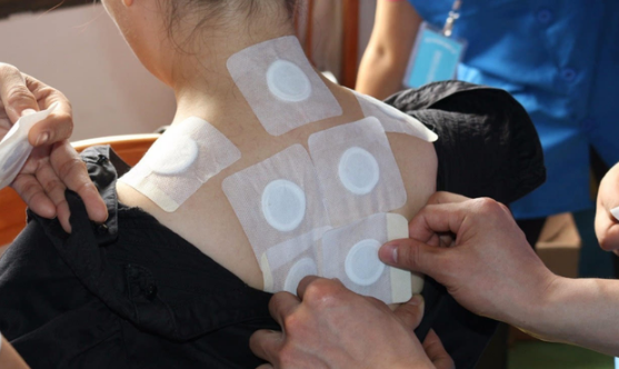 贴三伏贴后拉肚子怎么回事？三伏贴副作用大吗