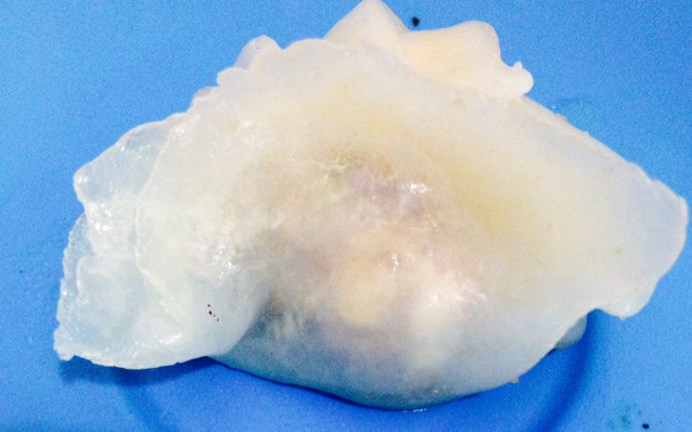 土豆大蒸饺十种美味做法，轻松学做不重样-图1